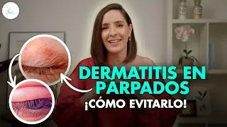 🔴 DERMATITIS en los PARPADOS ¿QUÉ ES y COMO SE CURA? @drapilarochoa - Dermatologa