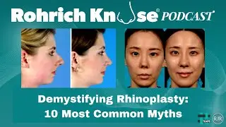 Demystifying Rhinoplasty: 10 Most Common Myths