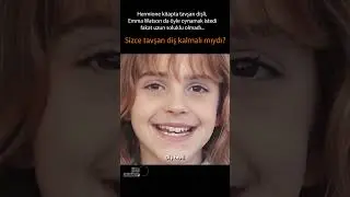 Sizce Hermione tavşan dişli kalmalı mıydı? 