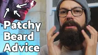 Patchy beard advice | 6 insider tips for success!