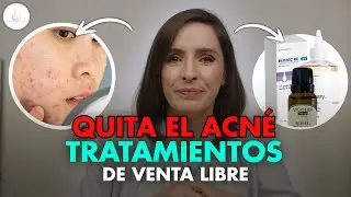 🔴 PRODUCTOS de SUPERMERCADO para TRATAR el ACNE ¿FUNCIONAN? @drapilarochoa - Dermatologa