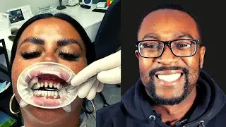 Turkey Teeth Nightmare DENTIST REACTS - Unable to sleep after dental procedure abroad