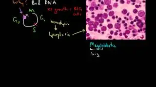 Macrocytic Anemia