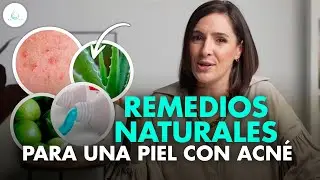 🔴 REMEDIOS CASEROS para ELIMINAR el ACNE ¿Mito o realidad? @drapilarochoa - Dermatologa