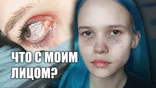 ПОЧЕМУ Я ТАК ВЫГЛЯЖУ?