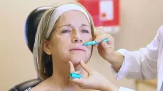 Dermatologist Demonstration of Laser Skin Resurfacing (Extended)