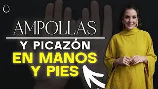 Tus MANOS y PIES se DESCAMAN?  | DISHIDROSIS QUÉ ES ?   @drapilarochoa - Dermatologa