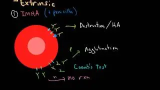 Hemolytic Anemia