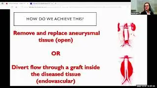 Michol Copper MD, PhD - Abdominal Aortic Aneurysm Lecture